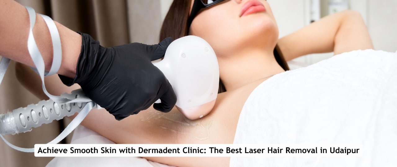 Laser Hair Removal