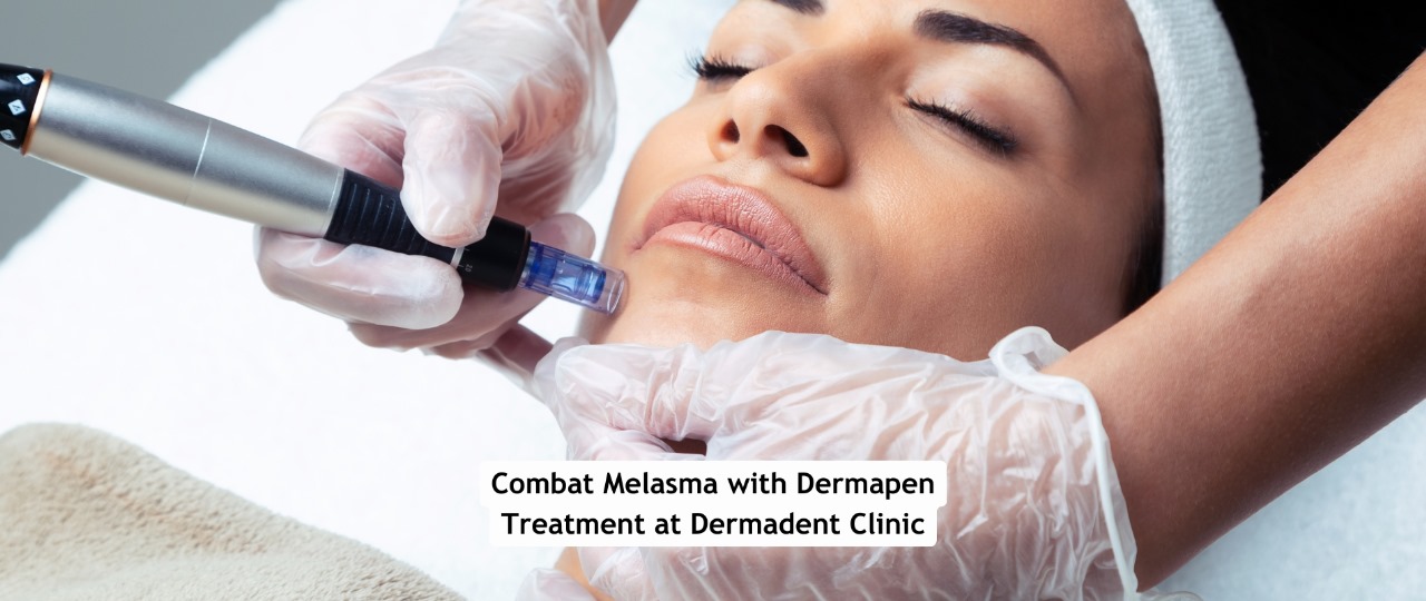 Dermapen Treatment