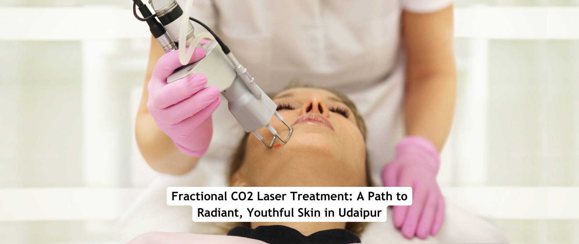 Fractional CO2 Laser Treatment