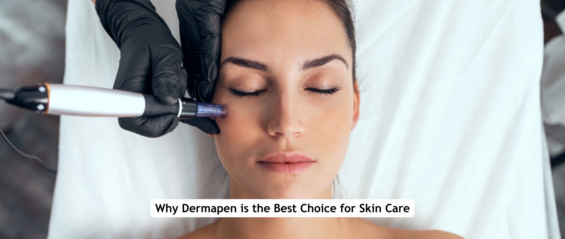 Dermapen treatment